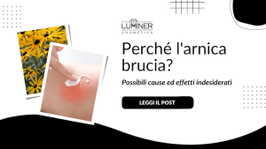 bruciore-arnica